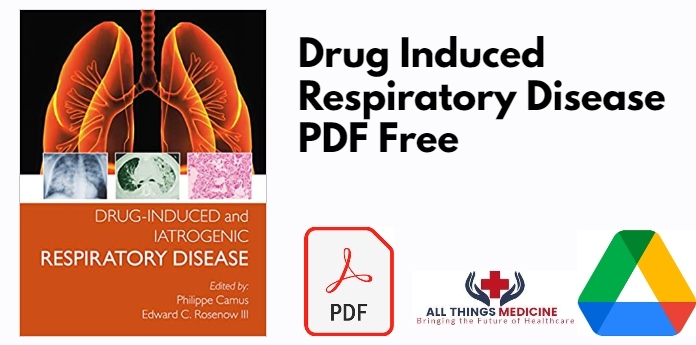 Drug Induced Respiratory Disease PDF