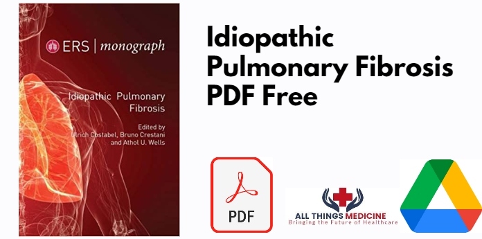 Idiopathic Pulmonary Fibrosis PDF