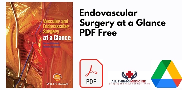 Endovascular Surgery at a Glance PDF