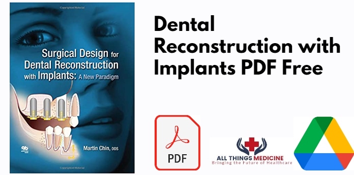 Dental Reconstruction with Implants PDF