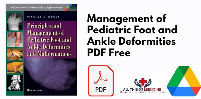 Management of Pediatric Foot and Ankle Deformities PDF
