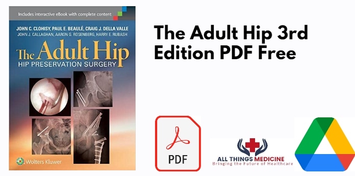 The Adult Hip 3rd Edition PDF
