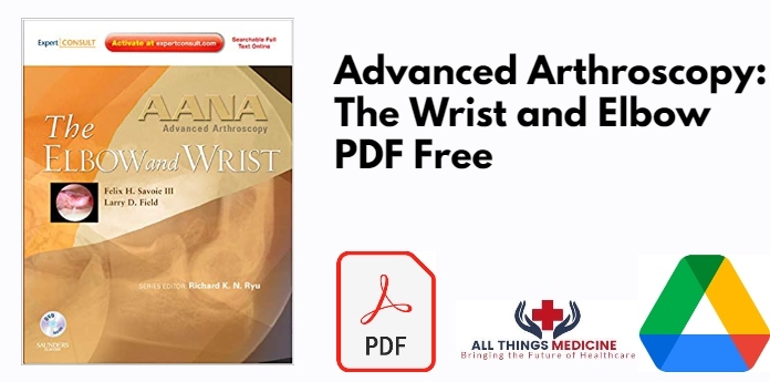 Advanced Arthroscopy: The Wrist and Elbow PDF