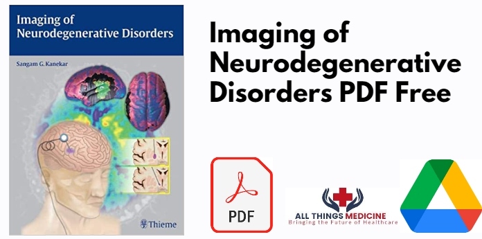 Imaging of Neurodegenerative Disorders PDF