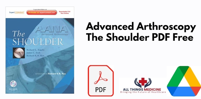 Advanced Arthroscopy The Shoulder PDF