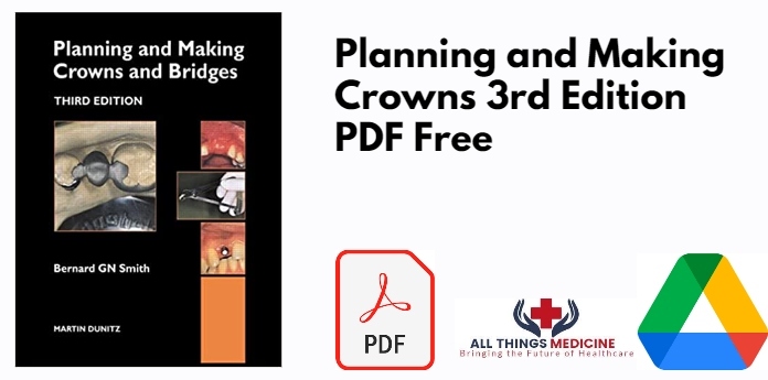 Planning and Making Crowns 3rd Edition PDF
