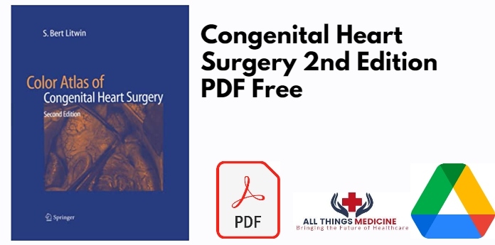 Congenital Heart Surgery 2nd Edition PDF