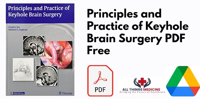 Principles and Practice of Keyhole Brain Surgery PDF