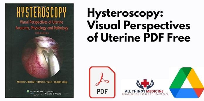 Hysteroscopy: Visual Perspectives of Uterine PDF
