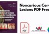 Noncarious Cervical Lesions PDF