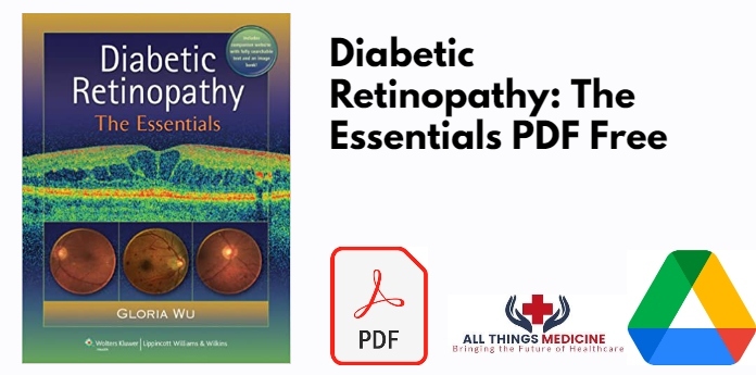 Diabetic Retinopathy: The Essentials PDF