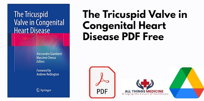 The Tricuspid Valve in Congenital Heart Disease PDF