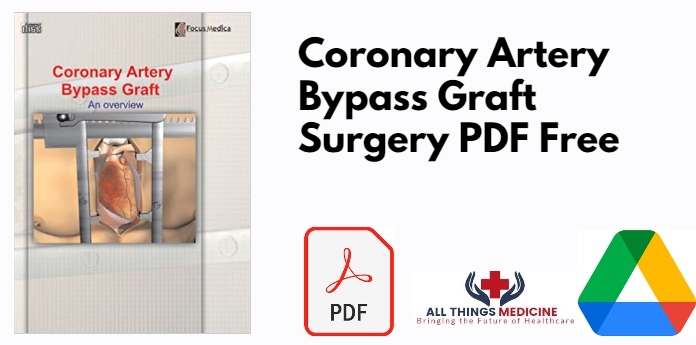 Coronary Artery Bypass Graft Surgery PDF