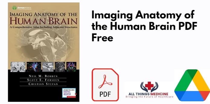 Imaging Anatomy of the Human Brain PDF