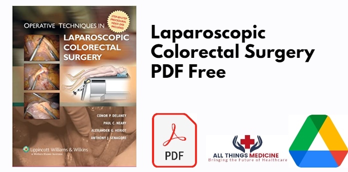 Laparoscopic Colorectal Surgery PDF