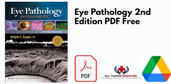 Eye Pathology 2nd Edition PDF