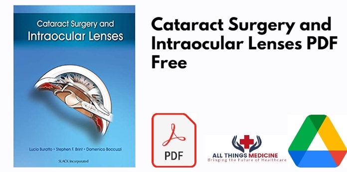 Cataract Surgery and Intraocular Lenses PDF