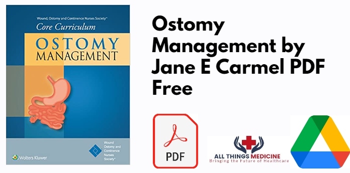 Ostomy Management by Jane E Carmel PDF