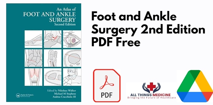 Foot and Ankle Surgery 2nd Edition PDF