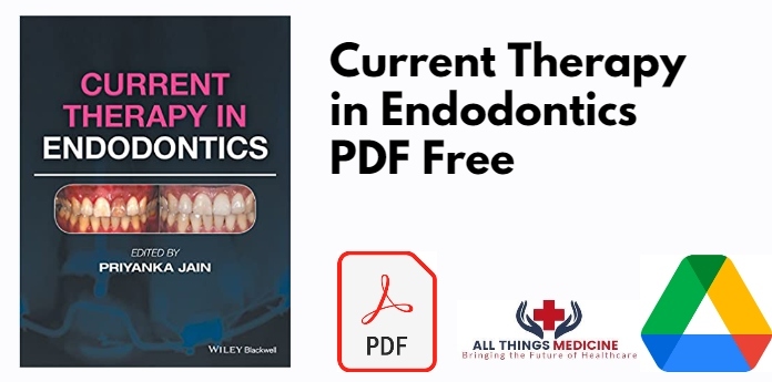 Current Therapy in Endodontics PDF