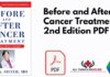Before and After Cancer Treatment 2nd Edition PDF