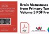 Brain Metastases from Primary Tumors Volume 3 PDF