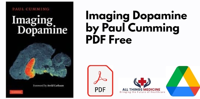 Imaging Dopamine by Paul Cumming PDF