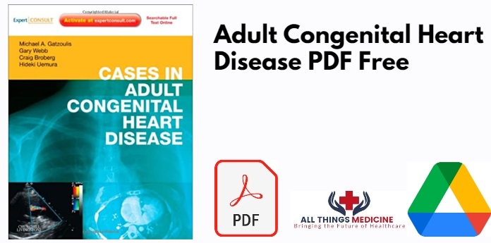 Adult Congenital Heart Disease PDF