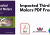 Impacted Third Molars PDF