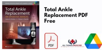 Total Ankle Replacement PDF