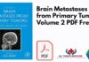 Brain Metastases from Primary Tumors Volume 2 PDF