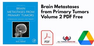 Brain Metastases from Primary Tumors Volume 2 PDF