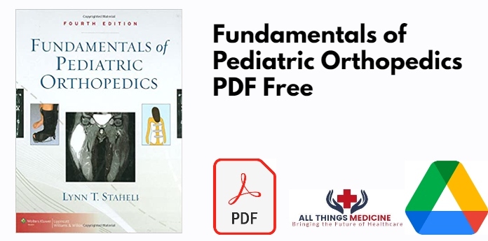 Fundamentals of Pediatric Orthopedics PDF