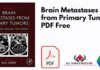 Brain Metastases from Primary Tumors PDF