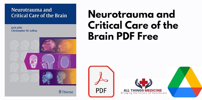 Neurotrauma and Critical Care of the Brain PDF