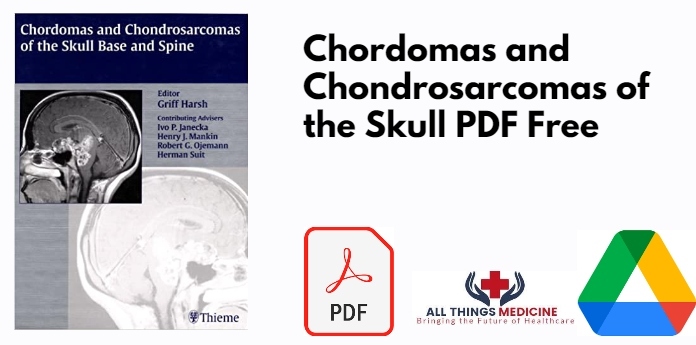 Chordomas and Chondrosarcomas of the Skull PDF