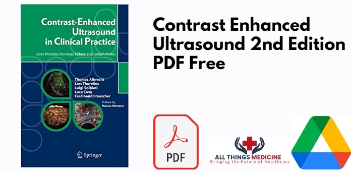 Contrast Enhanced Ultrasound 2nd Edition PDF
