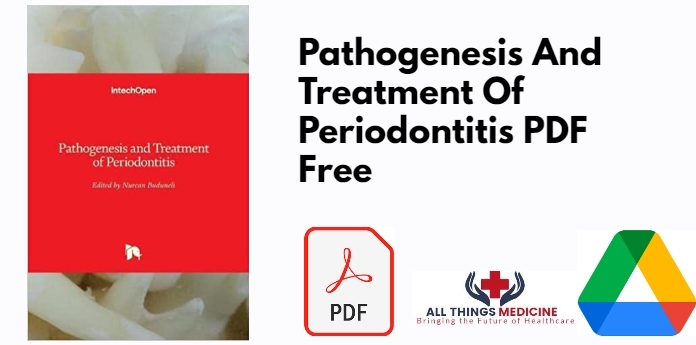 Pathogenesis And Treatment Of Periodontitis PDF