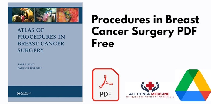 Procedures in Breast Cancer Surgery PDF