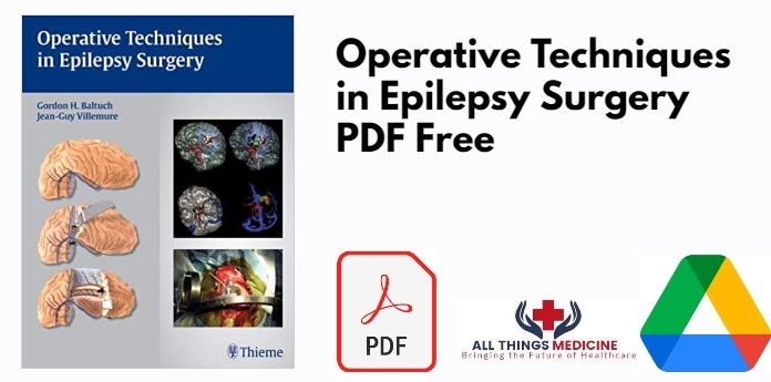 Operative Techniques in Epilepsy Surgery PDF