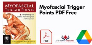 Myofascial Trigger Points PDF