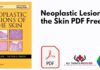 Neoplastic Lesions of the Skin PDF