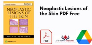 Neoplastic Lesions of the Skin PDF
