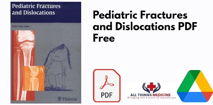 Pediatric Fractures and Dislocations PDF