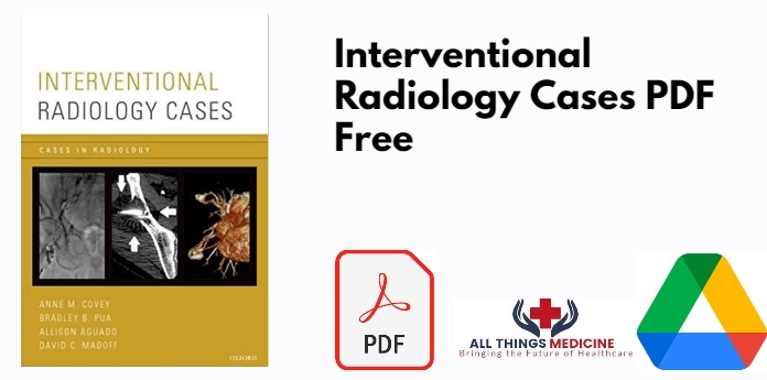 Interventional Radiology Cases PDF
