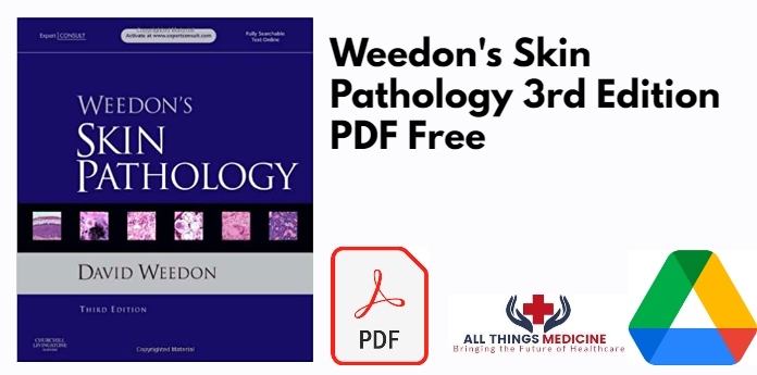 Weedon's Skin Pathology 3rd Edition PDF