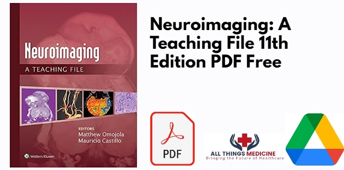 Neuroimaging: A Teaching File 11th Edition PDF