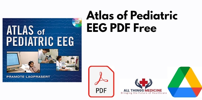Atlas of Pediatric EEG PDF