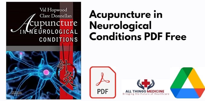 Acupuncture in Neurological Conditions PDF
