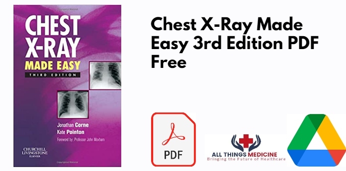 Chest X-Ray Made Easy 3rd Edition PDF